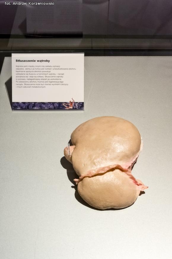 Wystawa BODY WORLDS & The Cycle of Life. Wybierz się podczas majówki