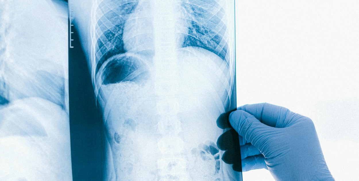 Zdjęcie dodane przez Anna Shvets: https://www.pexels.com/pl-pl/zdjecie/reka-patrzacy-trzymajacy-lekarz-4226258/