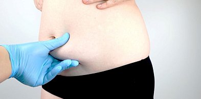 Jak przygotować się do zabiegu liposukcji?