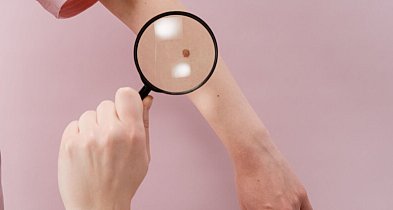 Chroń skórę! 500 mieszkańców Łódzkiego z czerniakiem