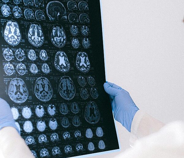 Codzienność opieki - życie bliskich z chorobą Alzheimera