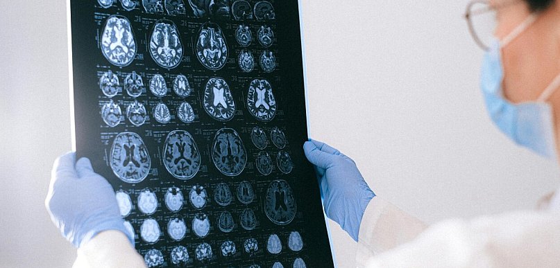 Codzienność opieki - życie bliskich z chorobą Alzheimera