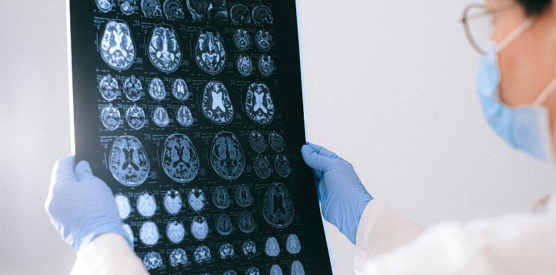 Codzienność opieki - życie bliskich z chorobą Alzheimera